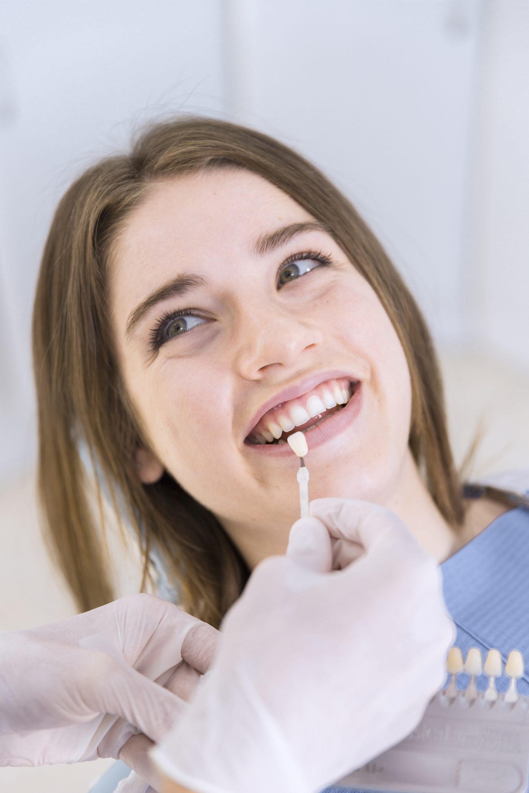 carillas dentales en viladecans